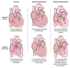 heart - iftikhar ul haq